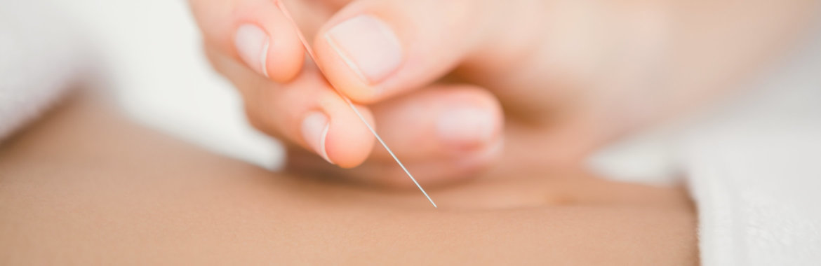 An acupuncture needle is inserted to help the well-being of a Medicare beneficiary.