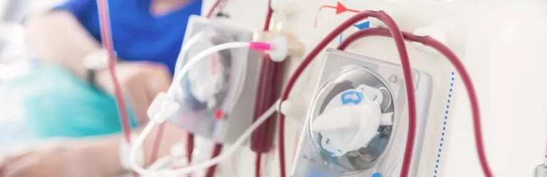 Close-up of medical dialysis equipment with tubes and controls, partially blurred healthcare professional in the background.
